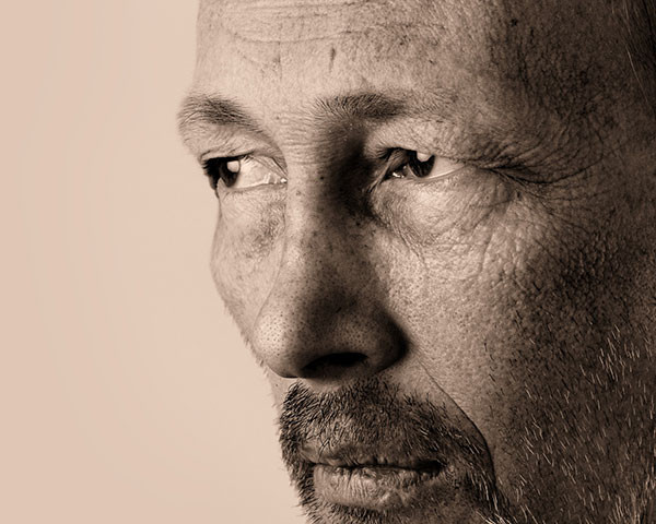 küme baş ağrısı kortizon