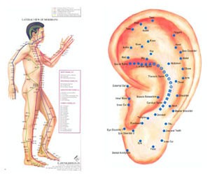 acupuncture-ear-dr-emel-gokmen