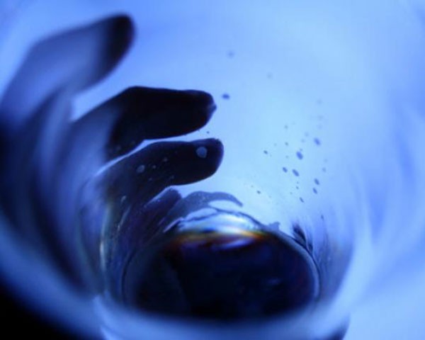 Vestibüler migren baş dönmeli migren belirtileri tanı ve tedavisi görsel dr emel gokmen