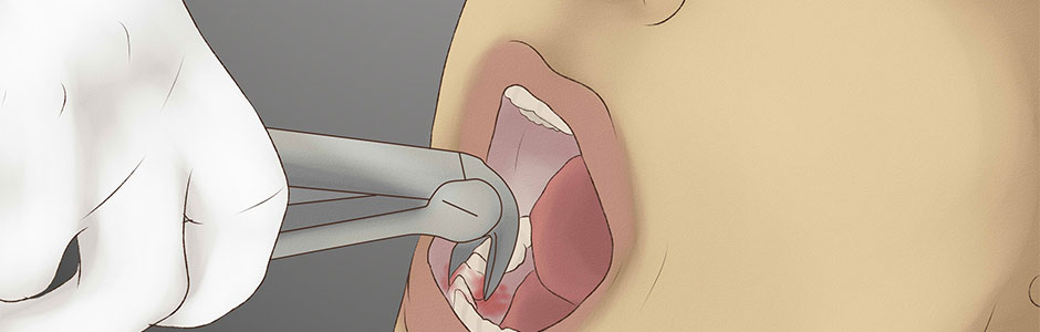 Resistant toothache story. Dr. Emel Gokmen