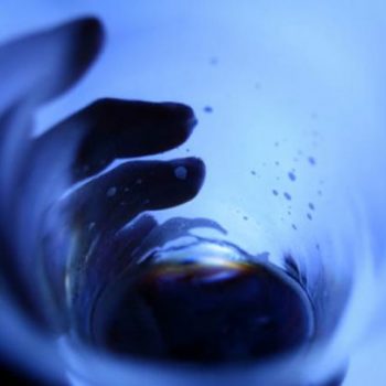 Featured image of vestibular migraine Dr. Emel Gokmen